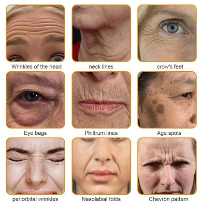 Botox Bee Venom Wrinkle Removal Cream | Anti-Aging cream